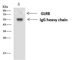 Invitrogen GLRB Polyclonal Antibody 100 μL; Unconjugated:Antibodies,