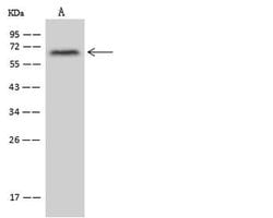 Invitrogen ZNF250 Polyclonal Antibody 100 &mu;L; Unconjugated:Antibodies,