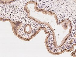 Invitrogen ZNF766 Polyclonal Antibody 100 μL; Unconjugated:Antibodies,
