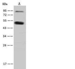 Invitrogen SNIP1 Polyclonal Antibody 100 &mu;L | Buy Online | Invitrogen&trade; | Fisher Scientific