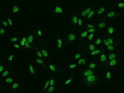 Invitrogen SLCO4C1 Polyclonal Antibody 100 &mu;L; Unconjugated:Antibodies,