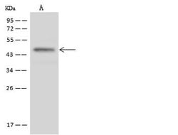 Invitrogen ST3GAL2 Polyclonal Antibody 100 μL; Unconjugated:Antibodies,