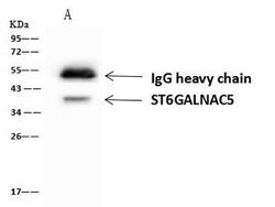 Invitrogen ST6GALNAC5 Polyclonal Antibody 100 &mu;L; Unconjugated:Antibodies,