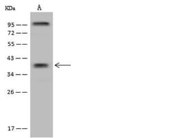 Invitrogen ST6GALNAC5 Polyclonal Antibody 100 &mu;L; Unconjugated:Antibodies,