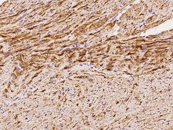 NDUFS2 Polyclonal Antibody, Invitrogen 100 &mu;L; Unconjugated:Antibodies,