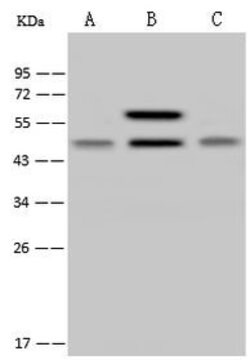 NDUFS2 Polyclonal Antibody, Invitrogen 100 &mu;L; Unconjugated:Antibodies,