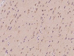 Invitrogen SYT11 Polyclonal Antibody 100 μL; Unconjugated:Antibodies,