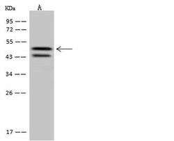 Invitrogen SYT11 Polyclonal Antibody 100 μL; Unconjugated:Antibodies,