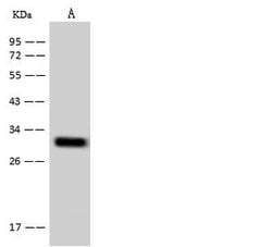 Invitrogen TM2D2 Polyclonal Antibody 100 μL; Unconjugated:Antibodies,