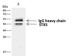 STX5 Polyclonal Antibody, Invitrogen 100 &mu;L; Unconjugated:Antibodies,