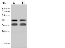STX5 Polyclonal Antibody, Invitrogen 100 &mu;L; Unconjugated:Antibodies,