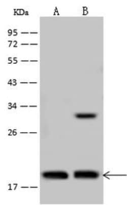 Invitrogen TCEAL3 Polyclonal Antibody 100 &mu;L; Unconjugated:Antibodies,