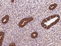 Invitrogen STX18 Polyclonal Antibody 100 &mu;L; Unconjugated:Antibodies,