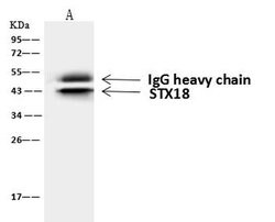 Invitrogen STX18 Polyclonal Antibody 100 &mu;L; Unconjugated:Antibodies,