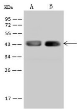 Invitrogen STX18 Polyclonal Antibody 100 &mu;L; Unconjugated:Antibodies,
