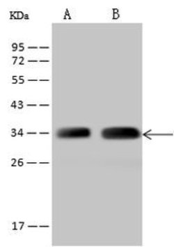 TTC19 Polyclonal Antibody:Antibodies, Polyclonal