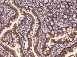 Invitrogen AdoHcyase 2 Polyclonal Antibody 100 &mu;L; Unconjugated:Antibodies,