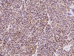 Invitrogen AdoHcyase 2 Polyclonal Antibody 100 &mu;L; Unconjugated:Antibodies,