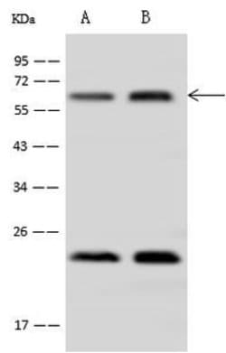 Invitrogen AdoHcyase 2 Polyclonal Antibody 100 &mu;L; Unconjugated:Antibodies,