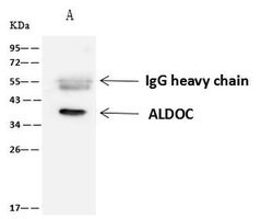 Invitrogen Aldolase C Polyclonal Antibody 100 &mu;L; Unconjugated:Anticorps,