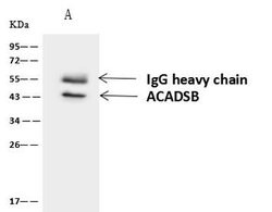 Invitrogen SBCAD Polyclonal Antibody 100 &mu;L; Unconjugated:Antibodies,