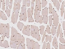Invitrogen CUTC Polyclonal Antibody 100 &mu;L | Buy Online | Invitrogen&trade; | Fisher Scientific