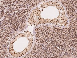 Invitrogen CUTC Polyclonal Antibody 100 &mu;L | Buy Online | Invitrogen&trade; | Fisher Scientific