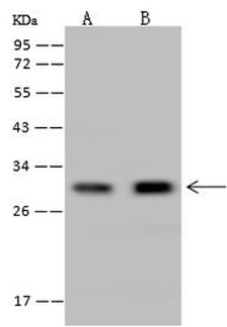 Invitrogen CUTC Polyclonal Antibody 100 &mu;L | Buy Online | Invitrogen&trade; | Fisher Scientific