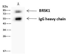 Invitrogen BRSK1 Polyclonal Antibody 100 &mu;L; Unconjugated:Antibodies,