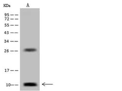 Invitrogen DPM2 Polyclonal Antibody 100 &mu;L | Buy Online | Invitrogen&trade; | Fisher Scientific