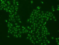 Invitrogen PPHLN1 Polyclonal Antibody 100 &mu;L | Buy Online | Invitrogen&trade; | Fisher Scientific