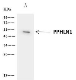 Invitrogen PPHLN1 Polyclonal Antibody 100 &mu;L | Buy Online | Invitrogen&trade; | Fisher Scientific
