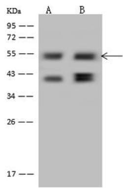 Invitrogen PPHLN1 Polyclonal Antibody 100 &mu;L | Buy Online | Invitrogen&trade; | Fisher Scientific