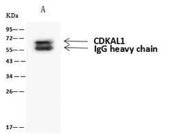 Invitrogen CDKAL1 Polyclonal Antibody 100 μL; Unconjugated:Antibodies,