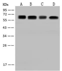 Invitrogen CDKAL1 Polyclonal Antibody 100 μL; Unconjugated:Antibodies,