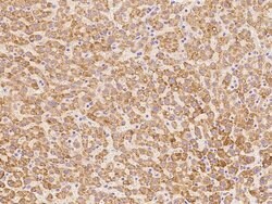 Invitrogen DHRS4 Polyclonal Antibody 100 &mu;L; Unconjugated:Antibodies,