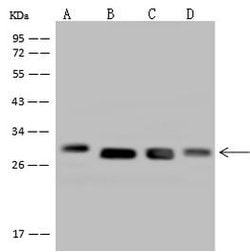 Invitrogen DHRS4 Polyclonal Antibody 100 &mu;L; Unconjugated:Antibodies,
