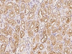 Invitrogen SHISA5 Polyclonal Antibody 100 μL; Unconjugated:Antibodies,