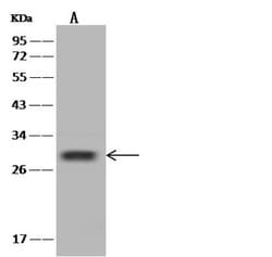 Invitrogen SHISA5 Polyclonal Antibody 100 μL; Unconjugated:Antibodies,