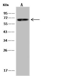 Invitrogen SPAG16 Polyclonal Antibody 100 μL; Unconjugated:Antibodies,
