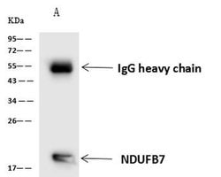 Invitrogen NDUFB7 Polyclonal Antibody 100 &mu;L; Unconjugated:Antibodies,