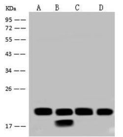 Invitrogen NDUFB7 Polyclonal Antibody 100 &mu;L; Unconjugated:Antibodies,