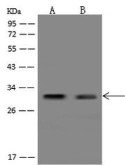 Invitrogen LYG2 Polyclonal Antibody 100 μL; Unconjugated:Antibodies,