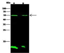 Invitrogen CES7 Polyclonal Antibody 100 μL; Unconjugated:Antibodies,