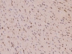 Invitrogen Neuroserpin Polyclonal Antibody 100 &mu;L; Unconjugated:Antibodies,