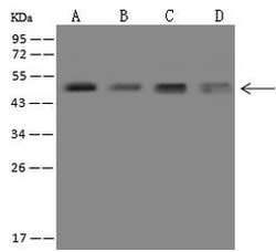 Invitrogen Neuroserpin Polyclonal Antibody 100 &mu;L; Unconjugated:Antibodies,