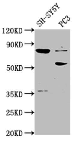 Invitrogen ABLIM1 Polyclonal Antibody 100 &mu;g; Unconjugated:Antibodies,