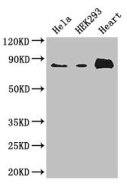 Invitrogen ABLIM1 Polyclonal Antibody 100 &mu;g; Unconjugated:Antibodies,