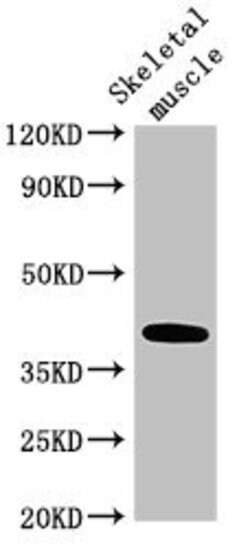 Invitrogen ABO Polyclonal Antibody 100 μg; Unconjugated:Antibodies,