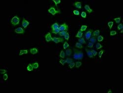Invitrogen V-ATPase G1 Polyclonal Antibody 100 μg; Unconjugated:Antibodies,